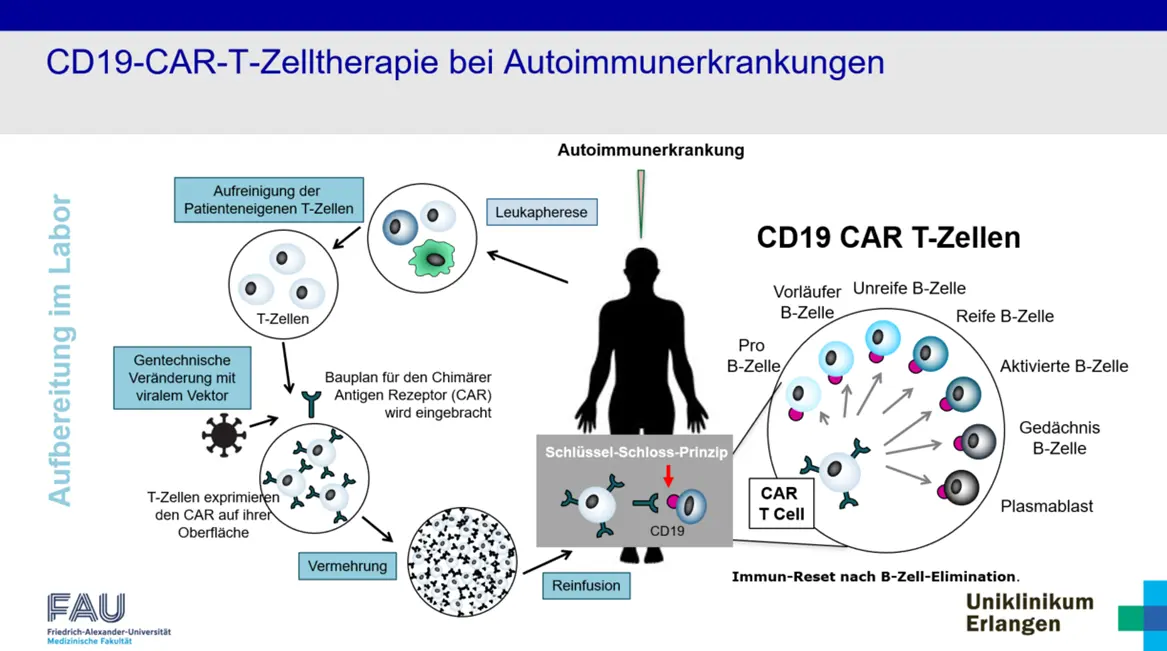 Illustration CAR-T-Zelltherapie bei Autoimmunkrankheiten