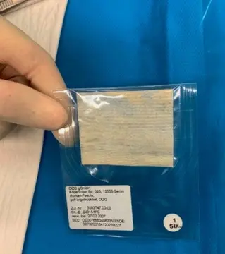 Abb. 1: Fascia-lata-Patch