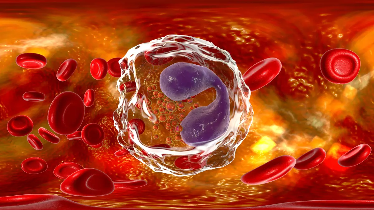 3D-Illustration einer Immunzelle umgeben von Erythrozyten in einem entzündeten Blutgefäß als Symbolbild für kardiovaskuläre Inflammation