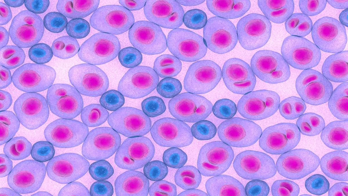 illustration von plasmazellen bei multiplem myelom in rosa und lila