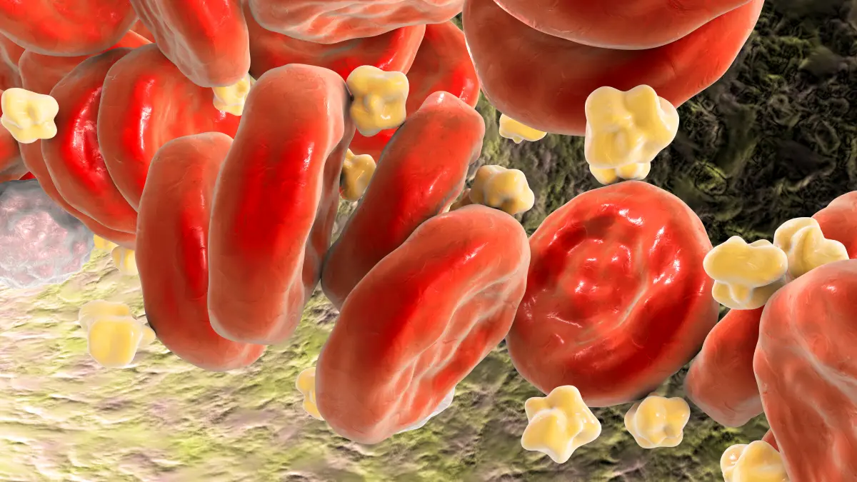 3D-Illustration von Lipoproteinen und Erythrozyten im Blutkreislauf bei Hypertriglyceridämie